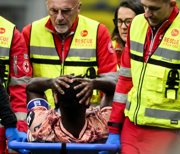 Infortunio Zapata: Inter-Torino 3-2